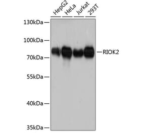 Western Blot - Anti-RIO2 Antibody (A80932) - Antibodies.com