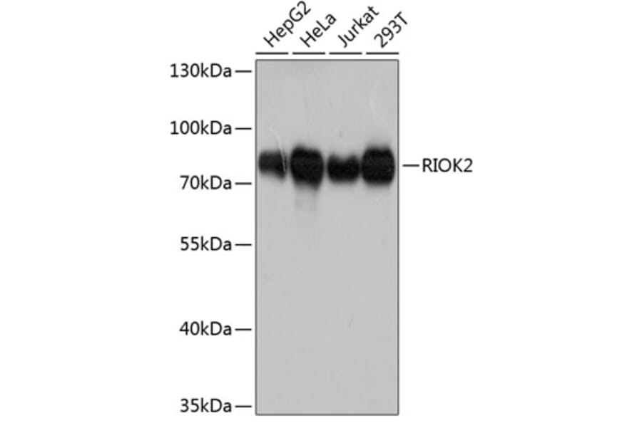 Western Blot - Anti-RIO2 Antibody (A80932) - Antibodies.com
