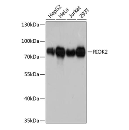Western Blot - Anti-RIO2 Antibody (A80932) - Antibodies.com