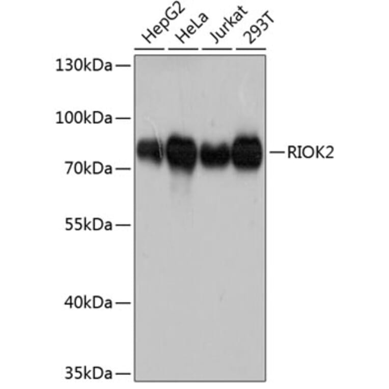 Western Blot - Anti-RIO2 Antibody (A80932) - Antibodies.com