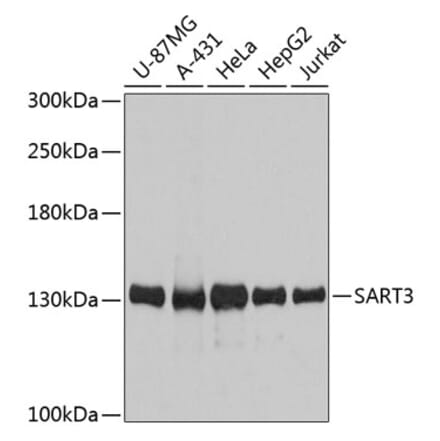 Western Blot - Anti-SART3 Antibody (A80933) - Antibodies.com