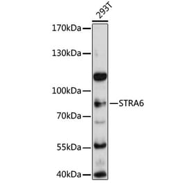 Western Blot - Anti-Stra6 Antibody (A80934) - Antibodies.com