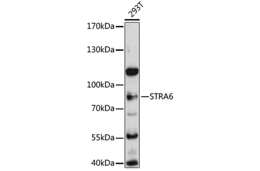 Western Blot - Anti-Stra6 Antibody (A80934) - Antibodies.com
