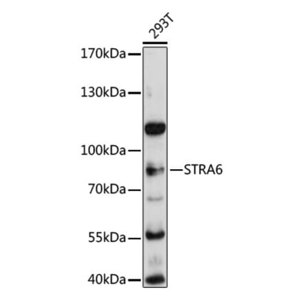 Western Blot - Anti-Stra6 Antibody (A80934) - Antibodies.com
