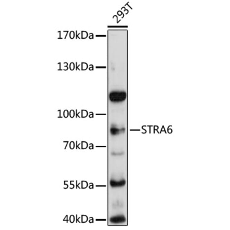 Western Blot - Anti-Stra6 Antibody (A80934) - Antibodies.com