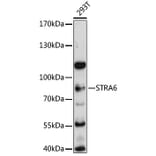Western Blot - Anti-Stra6 Antibody (A80934) - Antibodies.com