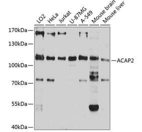 Western Blot - Anti-ACAP2 Antibody (A80935) - Antibodies.com