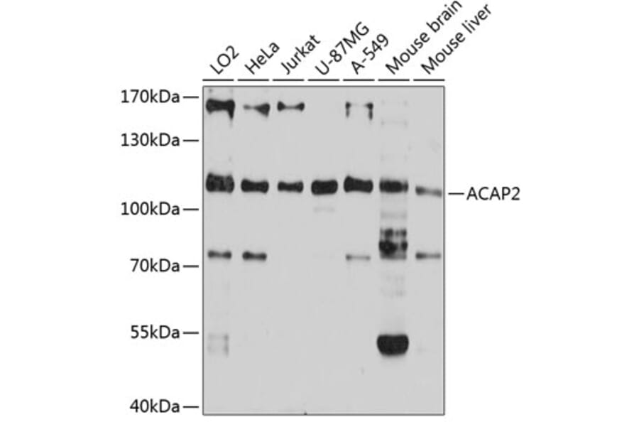 Western Blot - Anti-ACAP2 Antibody (A80935) - Antibodies.com