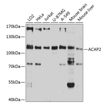 Western Blot - Anti-ACAP2 Antibody (A80935) - Antibodies.com