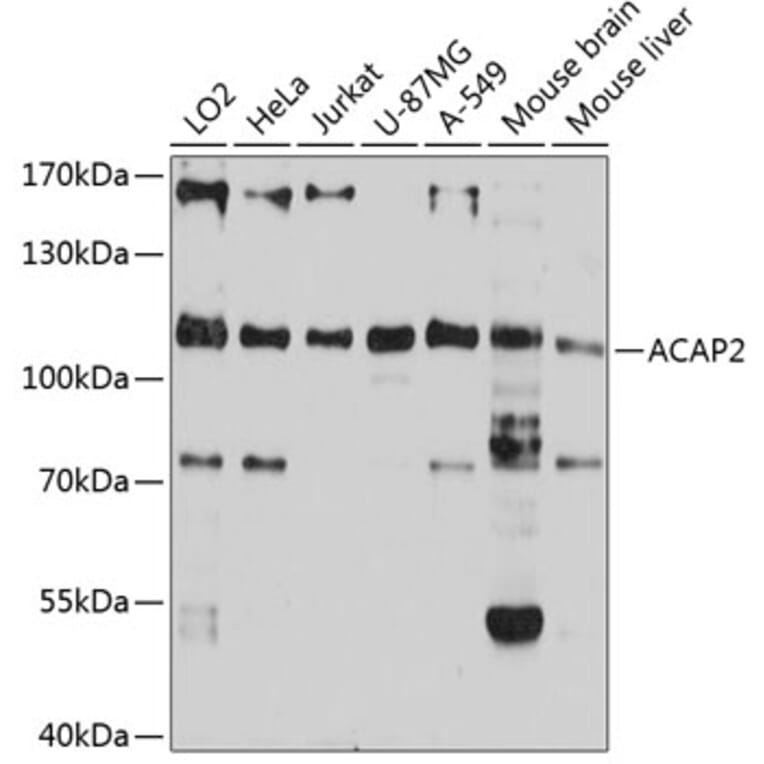 Western Blot - Anti-ACAP2 Antibody (A80935) - Antibodies.com