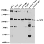 Western Blot - Anti-ACAP2 Antibody (A80935) - Antibodies.com