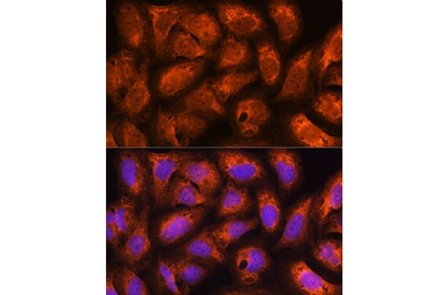 Immunofluorescence - Anti-ACAP2 Antibody (A80935) - Antibodies.com