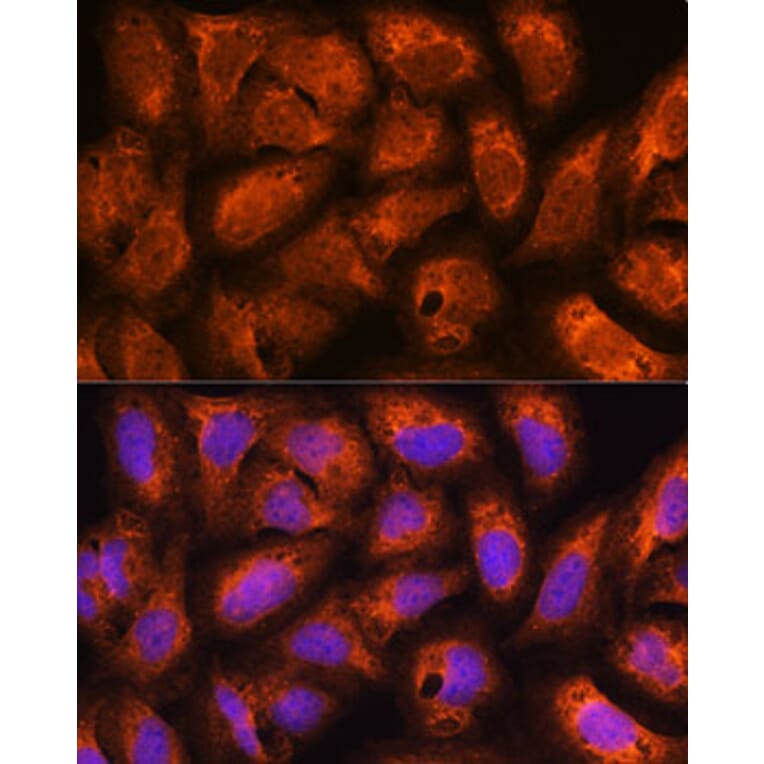 Immunofluorescence - Anti-ACAP2 Antibody (A80935) - Antibodies.com