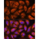 Immunofluorescence - Anti-ACAP2 Antibody (A80935) - Antibodies.com