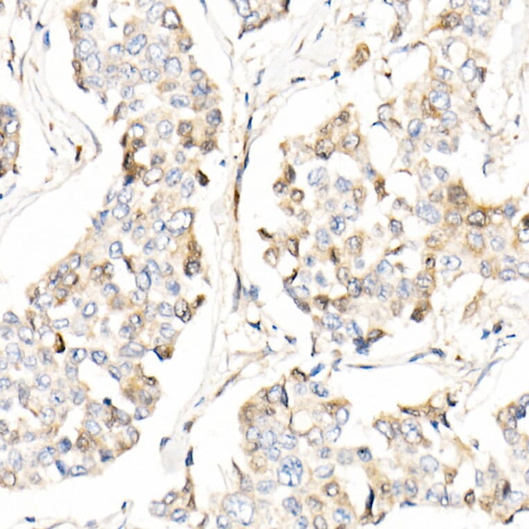 Immunohistochemistry - Anti-AMID Antibody (A80936) - Antibodies.com