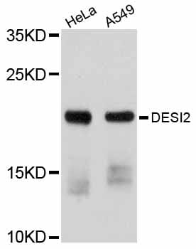 Western blot analysis of extracts of various cell lines, using Anti-DESI2 Antibody (A12129) at 1:1,000 dilution.
Secondary antibody: Goat Anti-Rabbit IgG (H+L) (HRP) (AS014) at 1:10,000 dilution.
Lysates / proteins: 25µg per lane.
Blocking buffer: 3% non-fat dry milk in TBST.
Detection: ECL Basic Kit (RM00020).
Exposure time: 90s.
