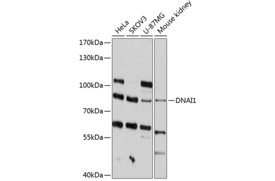 Western Blot - Anti-Dynein intermediate chain 1/DNAI1 Antibody (A80938) - Antibodies.com