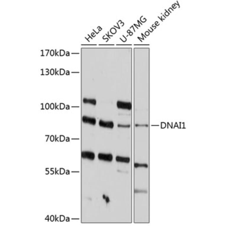 Western Blot - Anti-Dynein intermediate chain 1/DNAI1 Antibody (A80938) - Antibodies.com