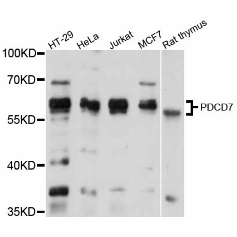 Western Blot - Anti-PDCD7 Antibody (A12133) - Antibodies.com