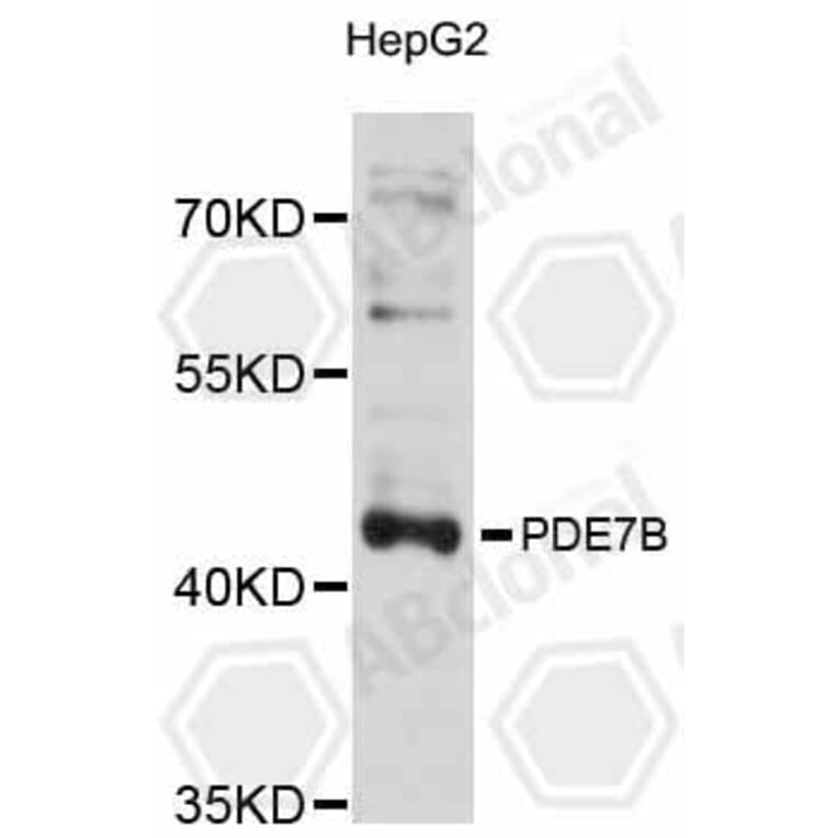 Western Blot - Anti-PDE7B Antibody (A12134) - Antibodies.com
