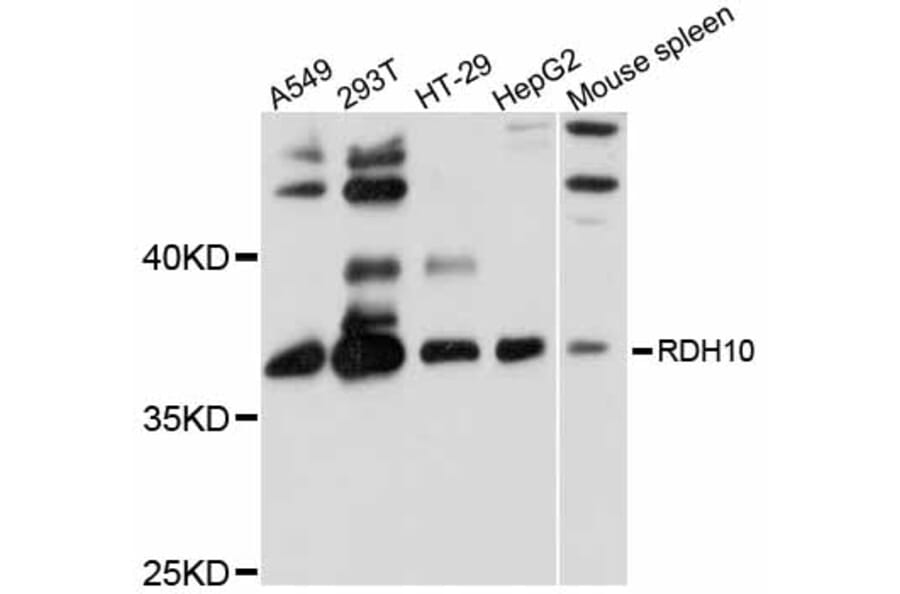 Western Blot - Anti-RDH10 Antibody (A12136) - Antibodies.com