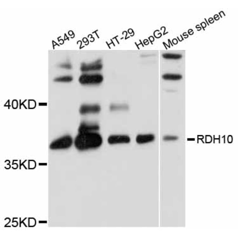 Western Blot - Anti-RDH10 Antibody (A12136) - Antibodies.com