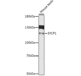 Western Blot - Anti-SCP1 Antibody (A80942) - Antibodies.com