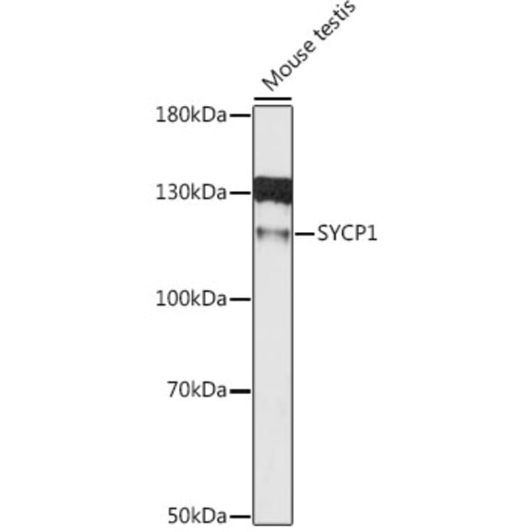 Western Blot - Anti-SCP1 Antibody (A80942) - Antibodies.com