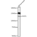 Western Blot - Anti-SCP1 Antibody (A80942) - Antibodies.com