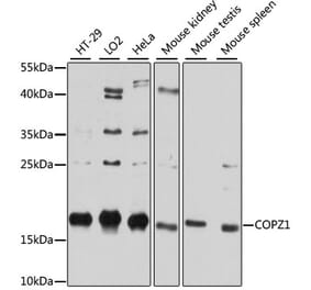 Western Blot - Anti-COPZ1 Antibody (A80943) - Antibodies.com