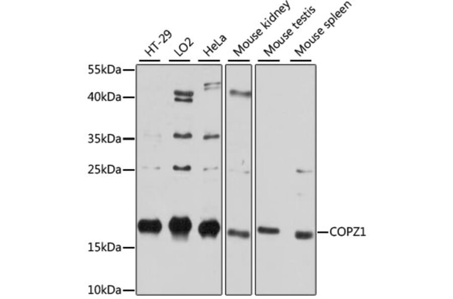 Western Blot - Anti-COPZ1 Antibody (A80943) - Antibodies.com