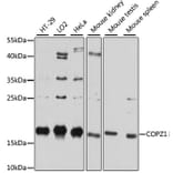 Western Blot - Anti-COPZ1 Antibody (A80943) - Antibodies.com