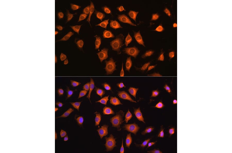 Immunofluorescence - Anti-COPZ1 Antibody (A80943) - Antibodies.com