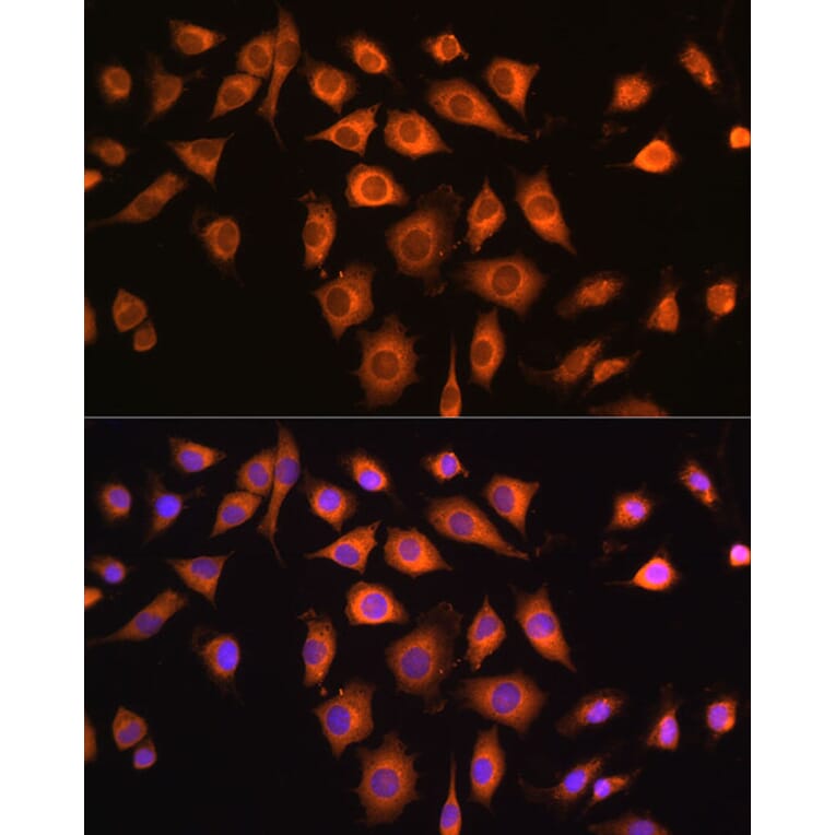 Immunofluorescence - Anti-COPZ1 Antibody (A80943) - Antibodies.com