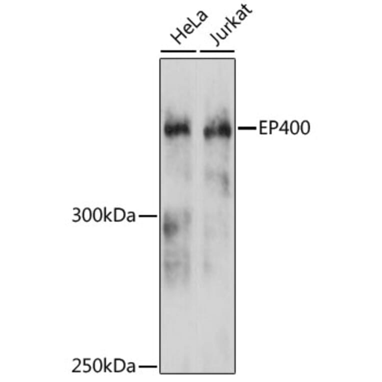 Western Blot - Anti-p400 Antibody (A80944) - Antibodies.com