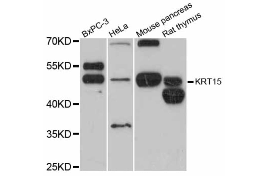 Western Blot - Anti-KRT15 Antibody (A12155) - Antibodies.com
