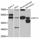Western Blot - Anti-KRT15 Antibody (A12155) - Antibodies.com