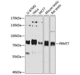 Western Blot - Anti-PRMT7 Antibody (A80946) - Antibodies.com
