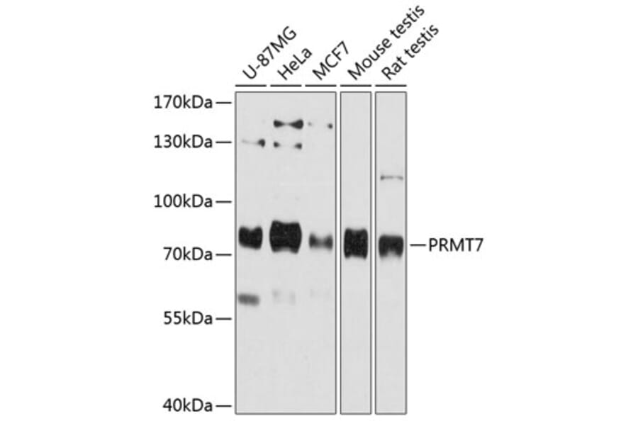 Western Blot - Anti-PRMT7 Antibody (A80946) - Antibodies.com