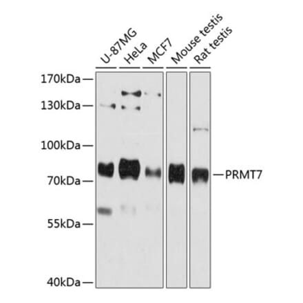 Western Blot - Anti-PRMT7 Antibody (A80946) - Antibodies.com