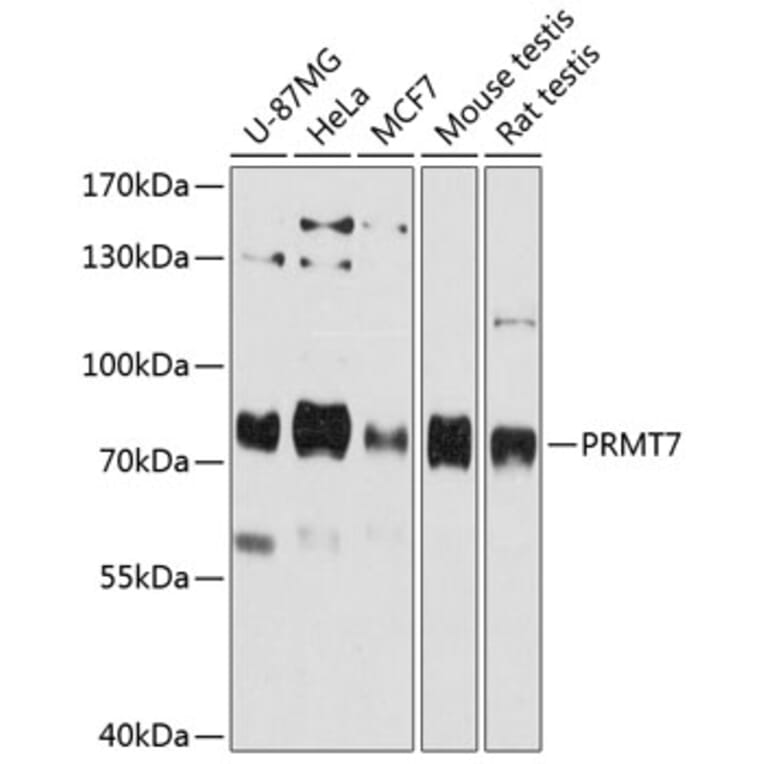 Western Blot - Anti-PRMT7 Antibody (A80946) - Antibodies.com