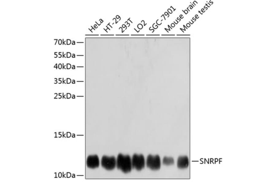 Western Blot - Anti-SNRPF Antibody (A80947) - Antibodies.com