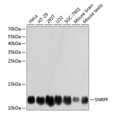 Western Blot - Anti-SNRPF Antibody (A80947) - Antibodies.com