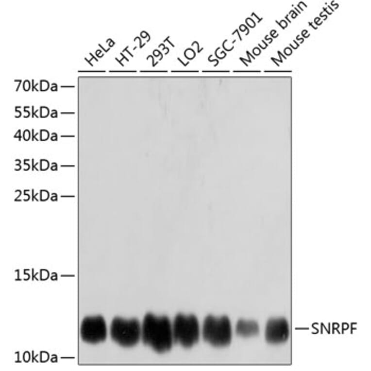 Western Blot - Anti-SNRPF Antibody (A80947) - Antibodies.com