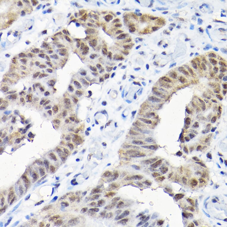 Immunohistochemistry - Anti-SNRPF Antibody (A80947) - Antibodies.com