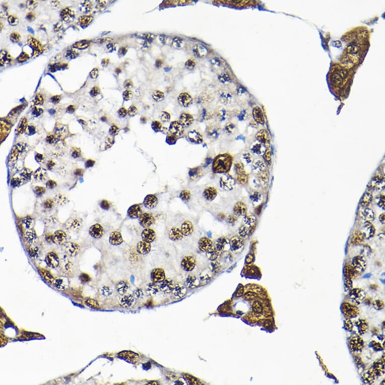 Immunohistochemistry - Anti-SNRPF Antibody (A80947) - Antibodies.com