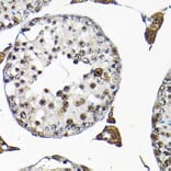 Immunohistochemistry - Anti-SNRPF Antibody (A80947) - Antibodies.com