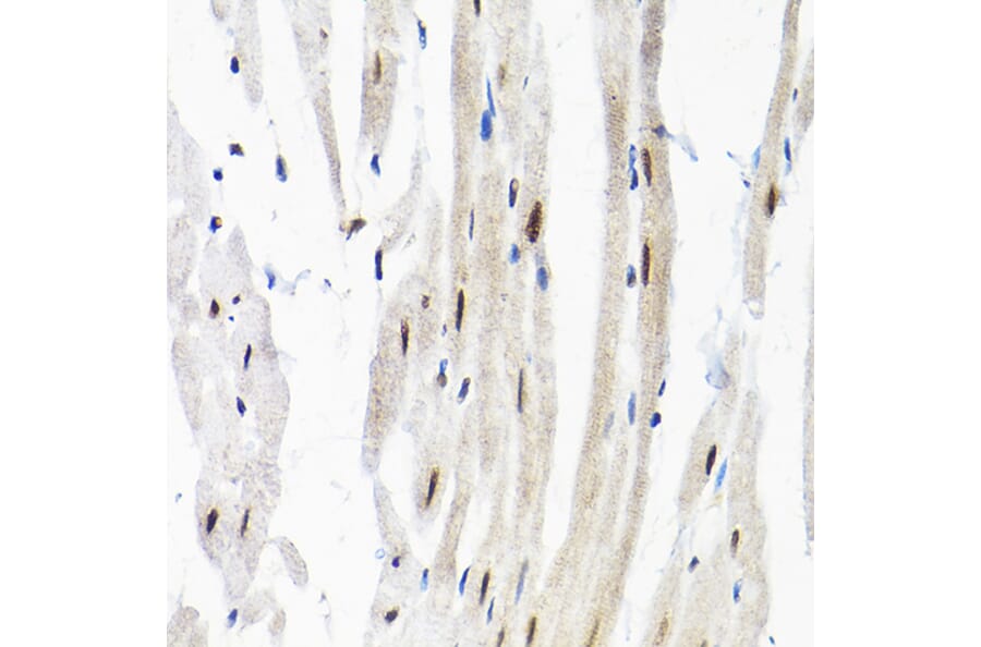Immunohistochemistry - Anti-SNRPF Antibody (A80947) - Antibodies.com