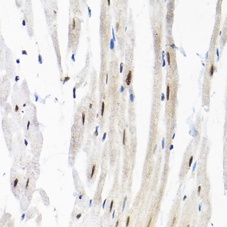 Immunohistochemistry - Anti-SNRPF Antibody (A80947) - Antibodies.com