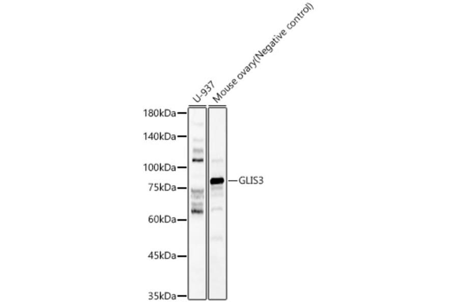 Western Blot - Anti-GLIS3 Antibody (A80948) - Antibodies.com